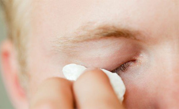 �۾�ģ����ʲôԭ������� �۾�ģ������ô����